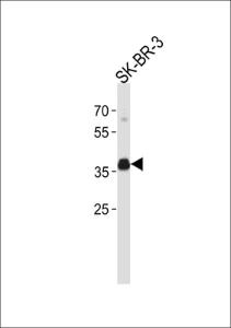 Anti-ESR1 isoform4 Rabbit Polyclonal Antibody (FITC (Fluorescein Isothiocyanate))