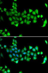 Immunofluorescence analysis of A549 cells using Anti-HSPA14 Antibody (A7107). Blue: DAPI for nuclear staining