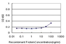 Anti-GTF3A Mouse Monoclonal Antibody [clone: 4B4]