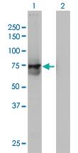 Anti-ACOX2 Mouse Monoclonal Antibody [clone: 1D1]