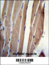 Anti-POLR2J Rabbit Polyclonal Antibody (APC (Allophycocyanin))