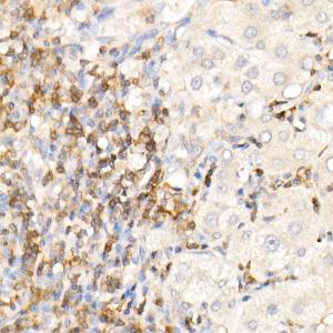 Immunohistochemistry analysis of paraffin-embedded human liver using Anti-CMTM3 Antibody (A308002) at a dilution of 1:100 (40x lens). Perform high pressure antigen retrieval with 10 mM citrate buffer pH 6.0 before commencing with IHC staining protocol.