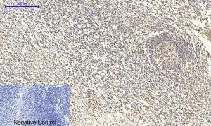 Immunohistochemical analysis of paraffin-embedded human Tonsil tissue using Anti-Smad4 Antibody at 1:200 (4°C overnight). Negative control was secondary antibody only.