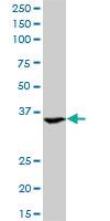 Anti-ASGR2 Mouse Monoclonal Antibody [clone: 1D7]