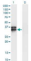 Anti-OLIG2 Mouse Monoclonal Antibody [clone: 2B11]