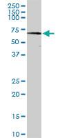 Anti-STRA6 Rabbit Polyclonal Antibody