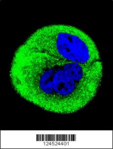 Anti-COXI Rabbit Polyclonal Antibody (AP (Alkaline Phosphatase))