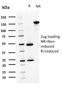 SDS-PAGE analysis of Anti-S100A4 Antibody [CPTC-S100A4-3] under non-reduced and reduced conditions; showing intact IgG and intact heavy and light chains, respectively. SDS-PAGE analysis confirms the integrity and purity of the antibody.