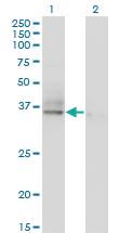 Anti-ASGR2 Mouse Monoclonal Antibody [clone: 1D7]