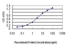 Anti-ACOX2 Mouse Monoclonal Antibody [clone: 1D1]