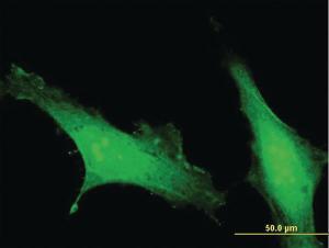 Anti-CRACR2A Mouse Polyclonal Antibody