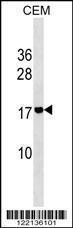 Anti-ADM2 Rabbit Polyclonal Antibody (HRP (Horseradish Peroxidase))