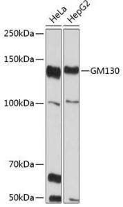 Anti-GM130 Rabbit Monoclonal Antibody [clone: ARC0589]