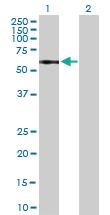 Anti-IL13RA1 Mouse Polyclonal Antibody