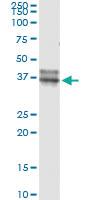 Anti-OLIG2 Mouse Monoclonal Antibody [clone: 2B11]