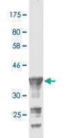 Anti-PCDH20 Mouse Monoclonal Antibody [clone: 1B7]