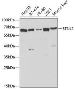 Western blot analysis of extracts of various cell lines, using Anti-BTNL2 Antibody (A12078) at 1:1,000 dilution