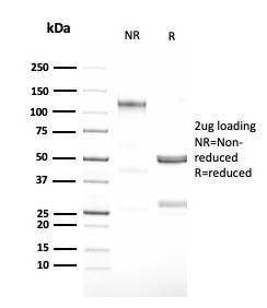 SDS-PAGE analysis of Anti-G-CSF Antibody [CSF3/3166R] under non-reduced and reduced conditions; showing intact IgG and intact heavy and light chains, respectively. SDS-PAGE analysis confirms the integrity and purity of the antibody.