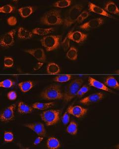 Anti-FAAH1 antibody