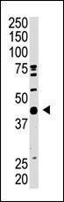 Anti-SAE1 Rabbit Polyclonal Antibody (Biotin)