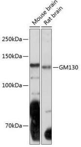 Anti-GM130 Rabbit Monoclonal Antibody [clone: ARC0589]