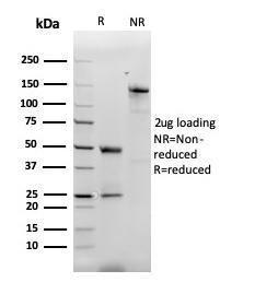 SDS-PAGE analysis of Anti-MCP2 Antibody [CCL8/3312] under non-reduced and reduced conditions; showing intact IgG and intact heavy and light chains, respectively. SDS-PAGE analysis confirms the integrity and purity of the Antibody