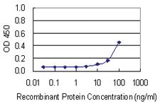 Anti-BRF1 Mouse Monoclonal Antibody [clone: 2E9]