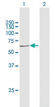 Anti-ACOX3 Rabbit Polyclonal Antibody