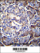 Anti-HIP1R Rabbit Polyclonal Antibody (APC (Allophycocyanin))