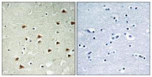 Immunohistochemical analysis of paraffin-embedded human brain tissue using Anti-ABHD14B Antibody. The right hand panel represents a negative control, where the antibody was pre-incubated with the immunising peptide