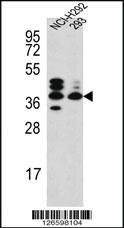 Anti-SRD5A3 Rabbit Polyclonal Antibody