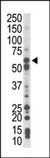 Anti-PCK1 Rabbit Polyclonal Antibody