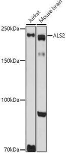 Western blot analysis of extracts of various cell lines, using Anti-Als2 Antibody (A12080) at 1:1,000 dilution