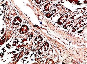 Immunohistochemical analysis of paraffin-embedded human colon using Anti-HLA-DQA1 Antibody