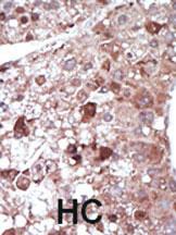 Anti-PCK1 Rabbit Polyclonal Antibody