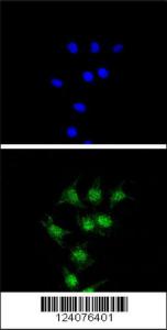 Anti-FANCC Rabbit Polyclonal Antibody (FITC (Fluorescein Isothiocyanate))