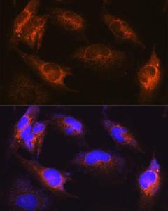 Immunofluorescence analysis of U-251MG cells using Anti-Als2 Antibody (A12080) at a dilution of 1:100 (40X lens). DAPI was used to stain the cell nuclei (blue)