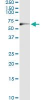 Anti-TP53 Antibody Pair