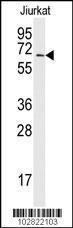 Anti-SUMO-activating Enzyme Subunit 2 Rabbit Polyclonal Antibody (AP (Alkaline Phosphatase))