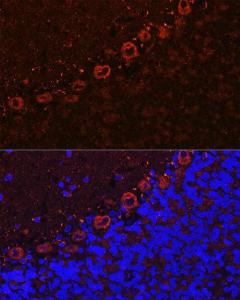 Immunofluorescence analysis of rat brain cells using Anti-Als2 Antibody (A12080) at a dilution of 1:100 (40X lens). DAPI was used to stain the cell nuclei (blue)