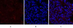 Immunofluorescence analysis of rat lung tissue using Anti-PERK Antibody (red) at 1:200 (4 °C overnight). Cy3 labelled secondary antibody was used at 1:300 (RT 50min). Panel A: Target. Panel B: DAPI. Panel C: Merge