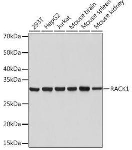 Western blot analysis of extracts of various cell lines, using Anti-RACK1 Antibody [ARC0837] (A305601) at 1:1,000 dilution. The secondary antibody was Goat Anti-Rabbit IgG H&L Antibody (HRP) at 1:10,000 dilution.