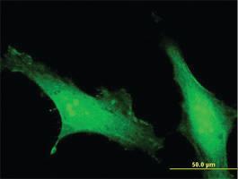 Anti-CRACR2A Mouse Polyclonal Antibody