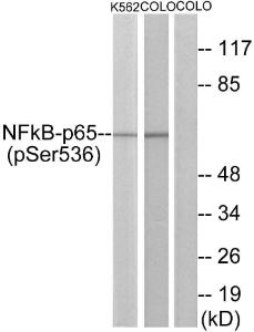 Western blot analysis of lysates from K562 cells and COLO cells using Anti-NF-kappaB p65 (phospho Ser536) Antibody. The right hand lane represents a negative control, where the antibody is blocked by the immunising peptide