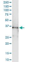 Anti-SEPT5 Polyclonal Antibody Pair