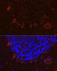 Immunofluorescence analysis of mouse brain cells using Anti-Als2 Antibody (A12080) at a dilution of 1:100 (40X lens). DAPI was used to stain the cell nuclei (blue)