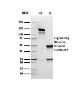 SDS-PAGE analysis of Anti-Cytokeratin 5 Antibody [rKRT5/6398] under non-reduced and reduced conditions; showing intact IgG and intact heavy and light chains, respectively SDS-PAGE analysis confirms the integrity and purity of the antibody