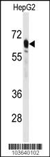 Anti-PCK2 Rabbit Polyclonal Antibody