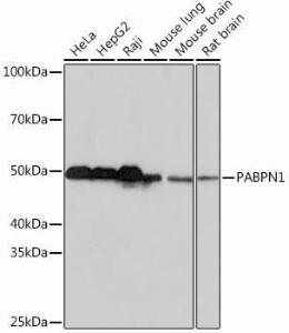 Anti-PABPN1 Rabbit Monoclonal Antibody [clone: ARC0730]