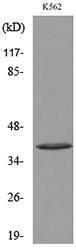 Western blot analysis of lysate from K562 cells using Anti-CD207 Antibody